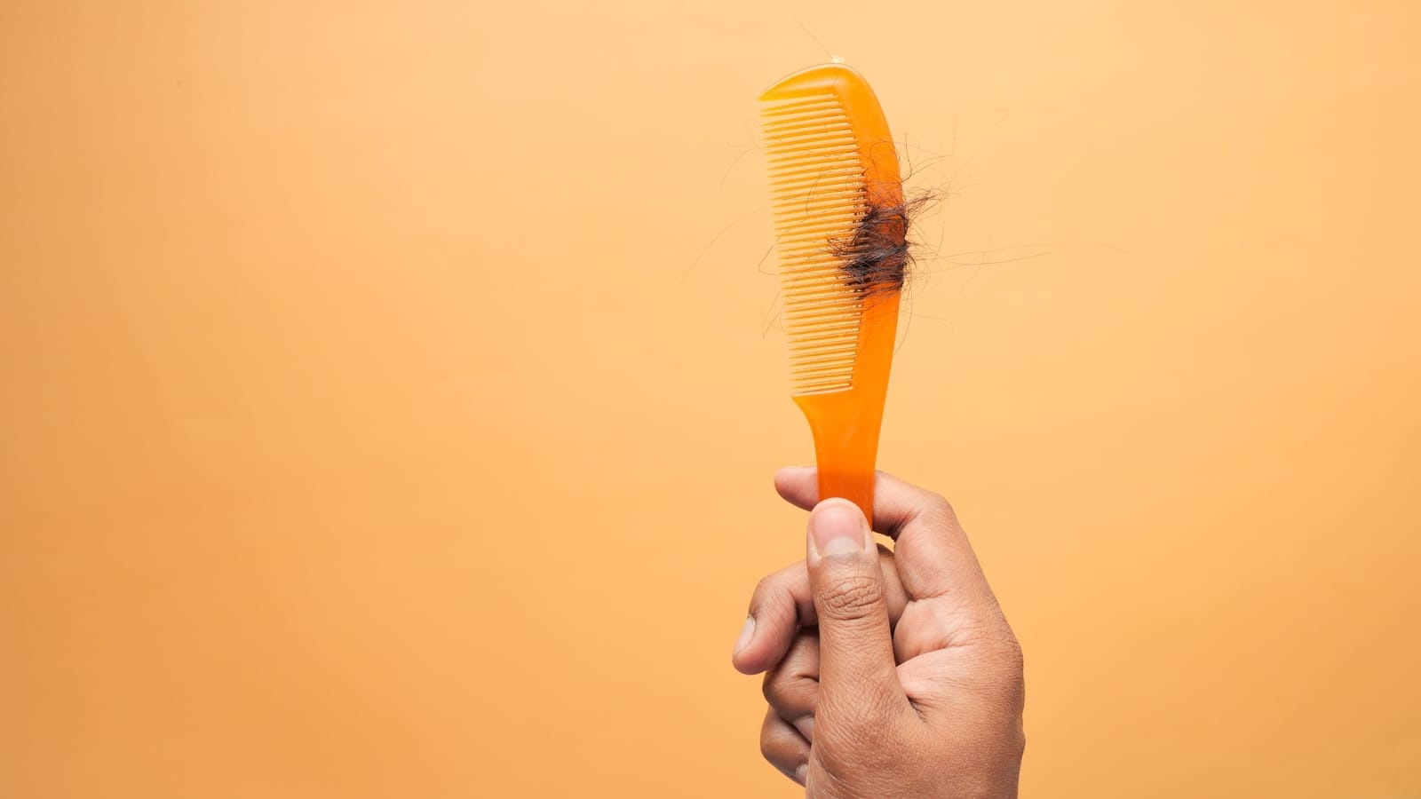 Hair loss that isn't genetic and the tests worth asking for
